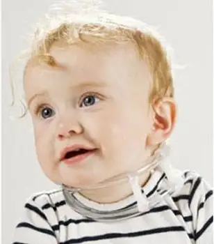 Reguliuojamas mažas kūdikis, kūdikis, vaikas torticollis torticollis orthotics kreivas kaklas išgydyti nepavyko ir korekcinių kreivai galvos operatio